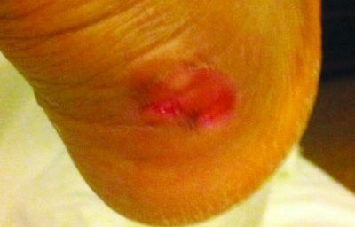 CBA球員抱怨李寧球鞋質(zhì)量太差 后腳跟險(xiǎn)被磨爛